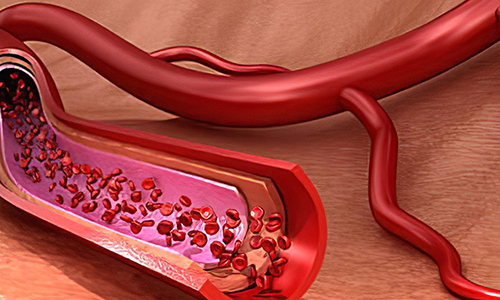 Angiogenesis-Aladdin Scientific